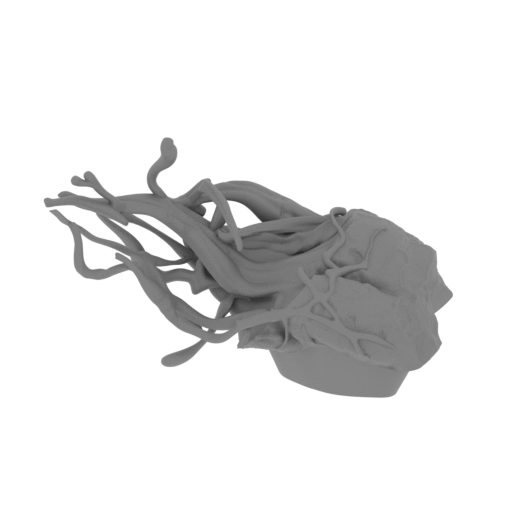 4_shoulder_R_FDM(repaired).stl